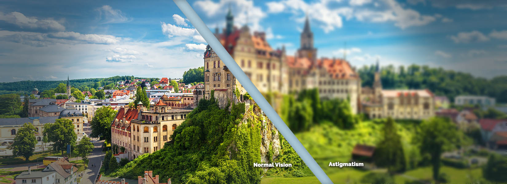 Astigmatism Treatment in Uptown