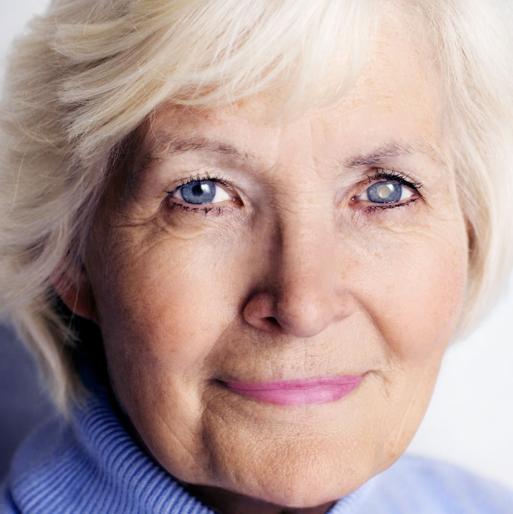 Cataract Surgery Co-Management in Uptown