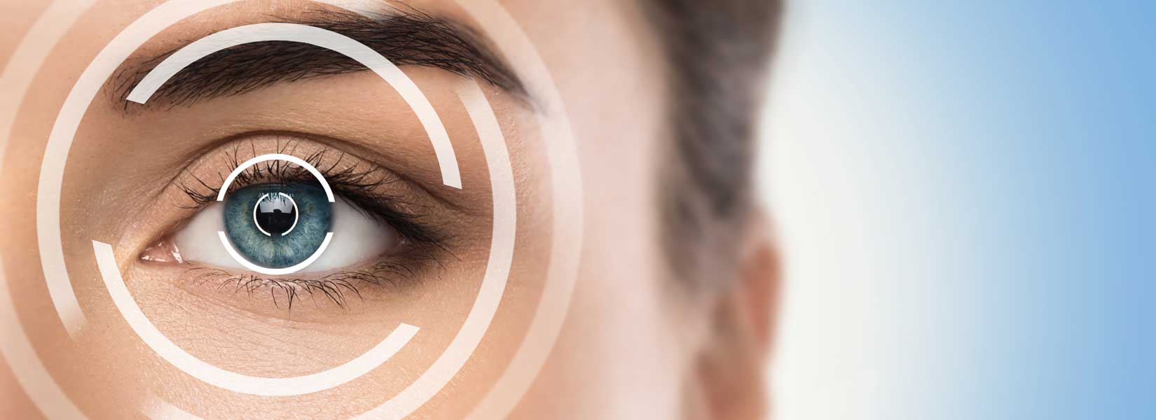 LASIK & Refractive Surgery Co-Management in Uptown